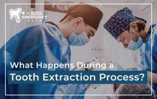 What Happens During A Tooth Extraction Process Featured Image