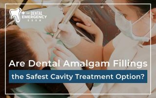 Are Dental Amalgam Fillings The Safest Cavity Treatment Option?