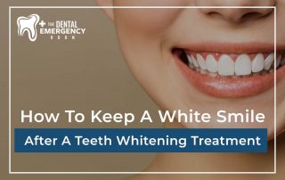 How To Keep A White Smile After A Teeth Whitening Treatment