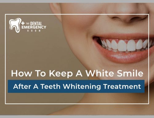 How To Keep A White Smile After A Teeth Whitening Treatment