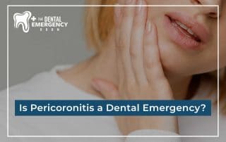Is Pericoronitis a Dental Emergency?