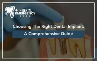 Choosing The Right Dental Implant: A Comprehensive Guide