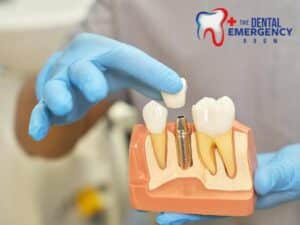 a dentist showing a dental implant for tooth replacement