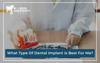 What Type Of Dental Implant Is Best For Me?