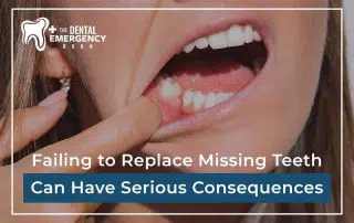 Failing To Replace Missing Teeth Can Have Serious Consequences