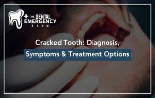 Cracked Tooth: Diagnosis, Symptoms & Treatment Options