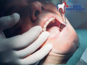 Dental exam revealing a Cracked Tooth during emergency treatment