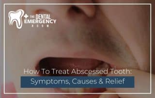 How To Treat Abscessed Tooth Symptoms, Causes & Relief