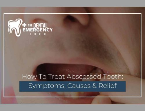How To Treat Abscessed Tooth: Symptoms, Causes & Relief