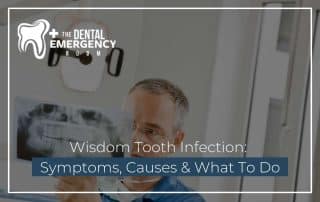 Wisdom Tooth Infection: Symptoms, Causes & What To Do