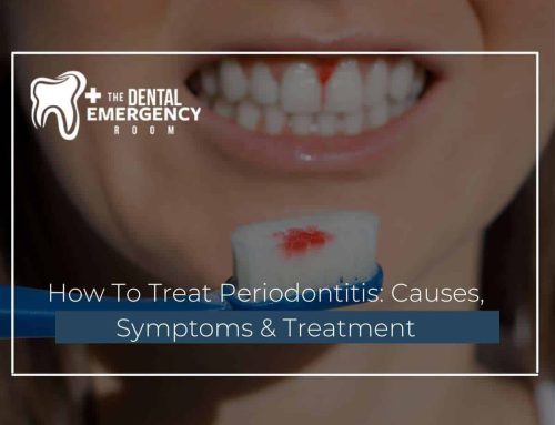 How To Treat Periodontitis: Causes, Symptoms & Treatment