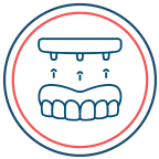 Full Dentures And Overdentures In Clearwater