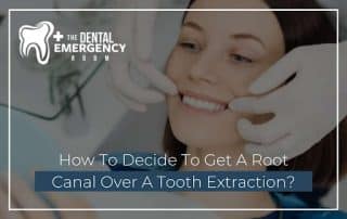 How To Decide To Get A Root Canal Over A Tooth Extraction