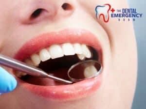 Close-up view of an open mouth during a dental examination, highlighting a tooth where a dental filling has fallen out.