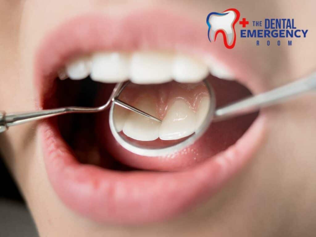 What to Do When a Filling Falls Out & Causes Pain