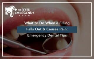 What to Do When a Filling Falls Out & Causes Pain