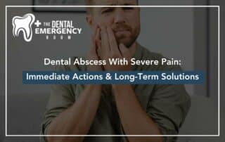 Dental Abscess With Severe Pain Immediate Actions & Long-Term Solutions