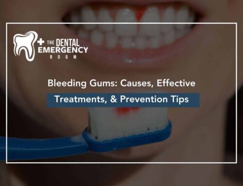 Bleeding Gums: Causes, Effective Treatments, & Prevention Tips