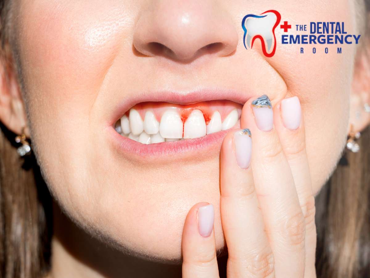 A close-up image of a smiling person's mouth, showing teeth and one spot of bleeding gums