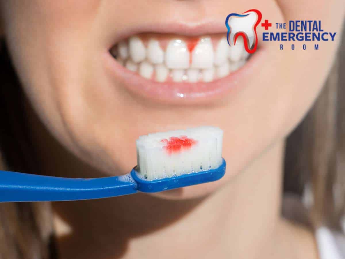 Close-up of a person brushing teeth with a blue toothbrush, with a small amount of blood on the bristles, indicating bleeding gums