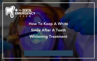 How To Keep A White Smile After A Teeth Whitening Treatment
